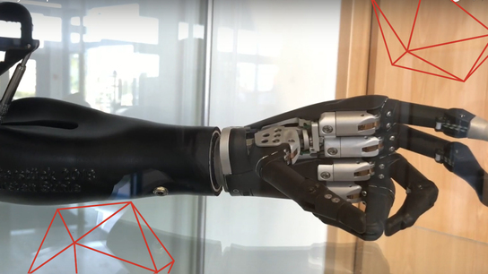 Creating a 3D-printed bionic arm with Artec Eva